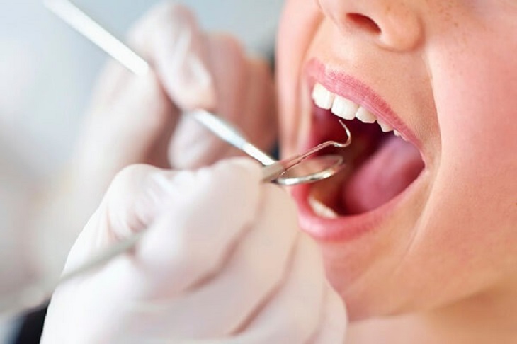 Lựa chọn nha khoa uy tín để điều trị sâu răng