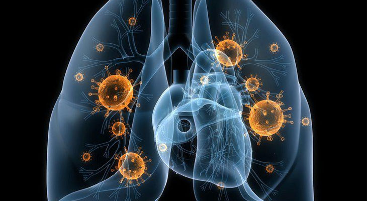 Viêm phế quản ở trẻ nhỏ có thể dẫn tới viêm phổi